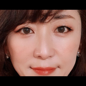 눈밑지방재배치<br>