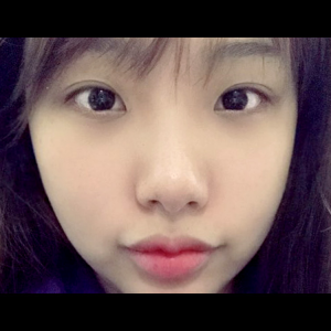 눈밑지방재배치<br>